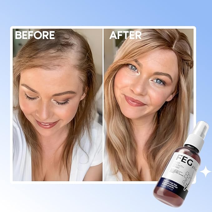 FEG Plus Hair Growth Spray - Treviacart