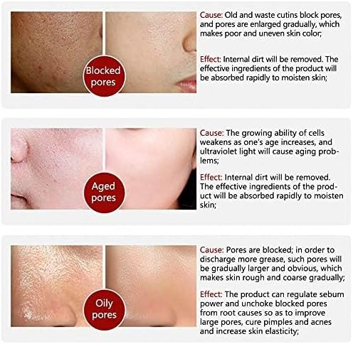 LANBENA - Pore Solution Serum (Original) My Store